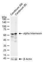 alpha Internexin Antibody in Western Blot (WB)