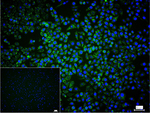 SDHB Recombinant Rabbit Monoclonal Antibody (2F7)