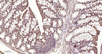 SDHB Antibody in Immunohistochemistry (Paraffin) (IHC (P))