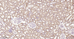 SDHB Antibody in Immunohistochemistry (Paraffin) (IHC (P))