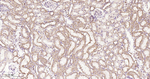 SDHB Antibody in Immunohistochemistry (Paraffin) (IHC (P))