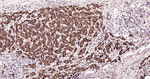 SDHB Antibody in Immunohistochemistry (Paraffin) (IHC (P))