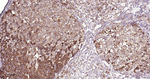 SDHB Antibody in Immunohistochemistry (Paraffin) (IHC (P))