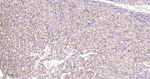 SDHB Antibody in Immunohistochemistry (Paraffin) (IHC (P))