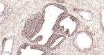 SDHB Antibody in Immunohistochemistry (Paraffin) (IHC (P))