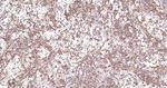SDHB Antibody in Immunohistochemistry (Paraffin) (IHC (P))