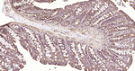 SDHB Antibody in Immunohistochemistry (Paraffin) (IHC (P))