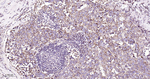 SDHB Antibody in Immunohistochemistry (Paraffin) (IHC (P))