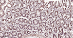 SDHB Antibody in Immunohistochemistry (Paraffin) (IHC (P))