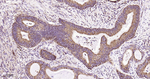 SDHB Antibody in Immunohistochemistry (Paraffin) (IHC (P))