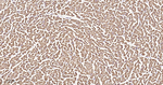 SDHB Antibody in Immunohistochemistry (Paraffin) (IHC (P))