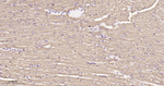 SDHB Antibody in Immunohistochemistry (Paraffin) (IHC (P))