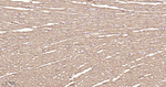 SDHB Antibody in Immunohistochemistry (Paraffin) (IHC (P))