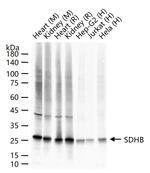 SDHB Antibody in Western Blot (WB)