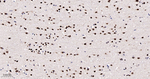 HDAC9 Antibody in Immunohistochemistry (Paraffin) (IHC (P))