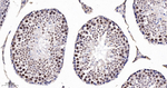 HDAC9 Antibody in Immunohistochemistry (Paraffin) (IHC (P))