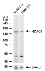 HDAC9 Antibody in Western Blot (WB)