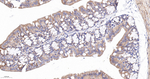 Citrate Synthase Antibody in Immunohistochemistry (Paraffin) (IHC (P))
