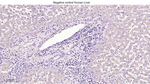 Zap-70 Antibody in Immunohistochemistry (Paraffin) (IHC (P))