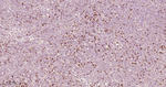 Zap-70 Recombinant Rabbit Monoclonal Antibody (8F7)