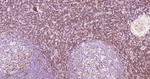 Zap-70 Antibody in Immunohistochemistry (Paraffin) (IHC (P))