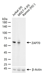 Zap-70 Antibody in Western Blot (WB)