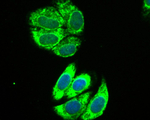 IL13RA1 Recombinant Rabbit Monoclonal Antibody (1C1)