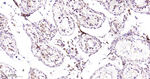 IL13RA1 Antibody in Immunohistochemistry (Paraffin) (IHC (P))