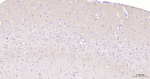 GABBR2 Antibody in Immunohistochemistry (Paraffin) (IHC (P))