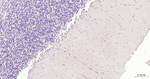 GABBR2 Antibody in Immunohistochemistry (Paraffin) (IHC (P))