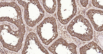RPS19 Antibody in Immunohistochemistry (Paraffin) (IHC (P))
