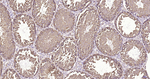 RPS19 Antibody in Immunohistochemistry (Paraffin) (IHC (P))