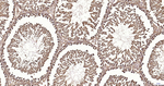 RPS19 Antibody in Immunohistochemistry (Paraffin) (IHC (P))