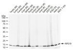 RPS19 Antibody in Western Blot (WB)