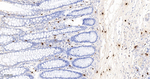 Mast Cell Chymase Antibody in Immunohistochemistry (Paraffin) (IHC (P))