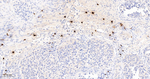 Mast Cell Chymase Antibody in Immunohistochemistry (Paraffin) (IHC (P))