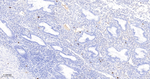 Mast Cell Chymase Antibody in Immunohistochemistry (Paraffin) (IHC (P))