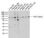 HIF-2 alpha Recombinant Rabbit Monoclonal Antibody (2G3)