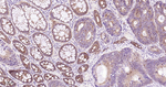 Desmoglein 2 Antibody in Immunohistochemistry (Paraffin) (IHC (P))