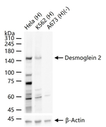 Desmoglein 2 Antibody in Western Blot (WB)