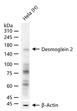 Desmoglein 2 Antibody in Western Blot (WB)