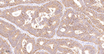 CD46 Antibody in Immunohistochemistry (Paraffin) (IHC (P))