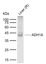ADH1A Recombinant Rabbit Monoclonal Antibody (14D1)