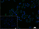 UPF1 Recombinant Rabbit Monoclonal Antibody (8B15)