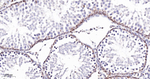 UNC84B Antibody in Immunohistochemistry (Paraffin) (IHC (P))