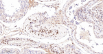 UNC84B Antibody in Immunohistochemistry (Paraffin) (IHC (P))