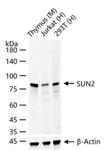 UNC84B Antibody in Western Blot (WB)