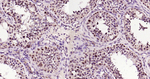 BRD2 Antibody in Immunohistochemistry (Paraffin) (IHC (P))