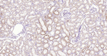 MARK2 Antibody in Immunohistochemistry (Paraffin) (IHC (P))