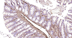 LUM Antibody in Immunohistochemistry (Paraffin) (IHC (P))